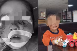 Loạt vụ chó thả rông cắn người trọng thương khiến netizen bức xúc