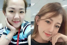 Chỉ sửa một điểm trên mặt, gái xinh thay đổi cuộc sống chóng mặt