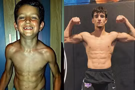 So kè ngoại hình khi trưởng thành của “cậu bé khỏe nhất thế giới“