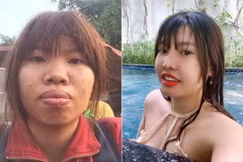 Ngỡ ngàng trước hình ảnh hiện tại của “Thị Nở tái sinh“