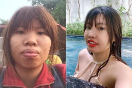 Ngỡ ngàng trước hình ảnh hiện tại của “Thị Nở tái sinh“