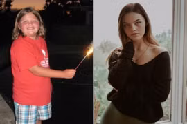 Dân tình phát hoảng với màn niềng răng lột xác được CĐM đăng tải