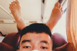 Đi xe khách, thanh niên bất ngờ bị “cắm sừng” bất đắc dĩ