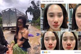 Những vụ đánh ghen kinh hoàng gây chấn động MXH