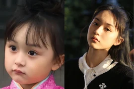 Nhan sắc hiện tại “tiểu mỹ nhân” bị netizen cấm phẫu thuật thẩm mỹ