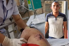 Lời khai của kẻ tra tấn nữ nhân viên như thời trung cổ vì từ chối kích dục