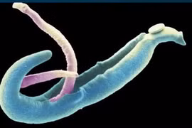 Điểm mặt 4 con “quái vật” trong cơ thể bạn