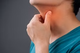 Đau họng thường xuyên đừng chủ quan, coi chừng ung thư