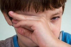 Thiếu niên dùng tay dụi mắt, ai ngờ mù luôn vì điều này