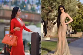 Chi tiền tỉ để thành Kim siêu vòng ba, cô gái suýt chết