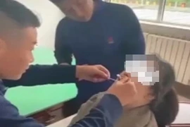 Giải cứu người phụ nữ bị vỏ ốc dính chặt vào môi khi ăn