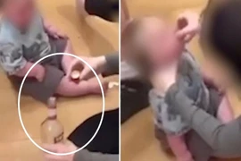 Mẹ dùng rượu mạnh làm “siro trị cảm lạnh”, con khóc thét 