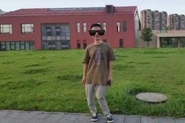 Chàng trai có xương sống cong như sợi mì chỉ vì thiếu vitamin này