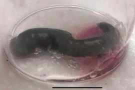 Ớn lạnh bé gái bị đỉa chui vào lỗ mũi ký sinh