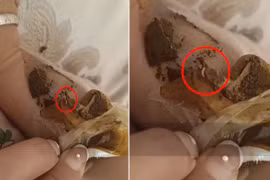 Người mẹ ân hận vì con gái sốt lại chữa theo cách của tiệm massage 