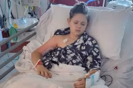 Bác sĩ chẩn đoán nhầm, bé gái tưởng giảm thị lực hóa u não