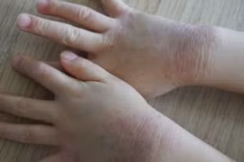 Mẹ tưởng chăm con tốt nhưng thật ra hại con vì điều này