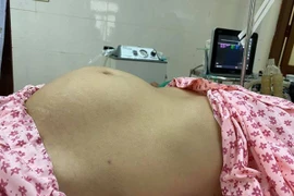 Bụng to như mang thai, đi khám mới biết mang khối u nguy hiểm