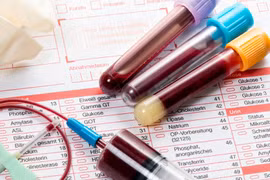 Biết nhóm máu của con, chồng lập tức đòi ly hôn vợ vừa sinh