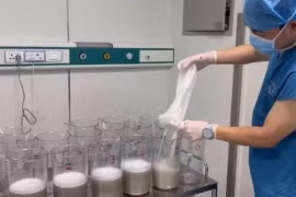 Hút 17 lít “sữa” khỏi phổi bệnh nhân, bác sĩ sốc nặng