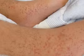 Thức khuya lâu ngày, cô gái hóa “quái vật” không dám soi gương 