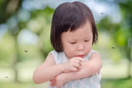 Chuyên gia nói gì về thông tin người ăn nhiều thịt thu hút muỗi hơn?