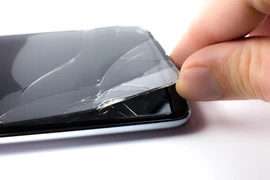 Không thay kính cường lực điện thoại vỡ, người phụ nữ bị u thần kinh 