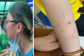 Bộ GD&ĐT chỉ đạo xử lý vụ bạo lực trong học sinh trường Quốc tế TP.HCM