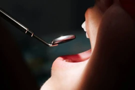 Hôi miệng nửa năm, đi khám nào ngờ mắc bệnh ung thư quái ác