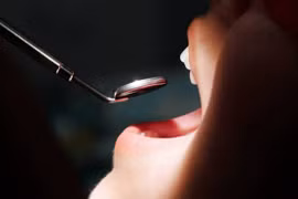 Hôi miệng nửa năm, đi khám nào ngờ mắc bệnh ung thư quái ác