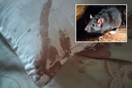 Đang ngủ thì cổ đau nhói, tỉnh dậy phát hiện điều ghê rợn 