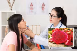 Người phụ nữ 35 tuổi bị ung thư tuyến giáp vì loại quả phổ biến