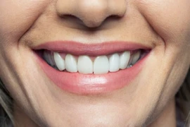 10 mẹo điều trị viêm lợi tại nhà cực kỳ hiệu quả