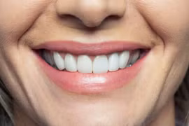 10 mẹo điều trị viêm lợi tại nhà cực kỳ hiệu quả