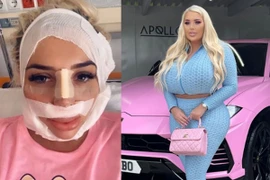 Cô gái phẫu thuật nâng ngực liên tục, bác sĩ cũng ám ảnh