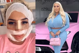 Cô gái phẫu thuật nâng ngực liên tục, bác sĩ cũng ám ảnh