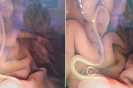 Cứ ăn món này là tiêu chảy, thanh niên trả giá vì sở thích 