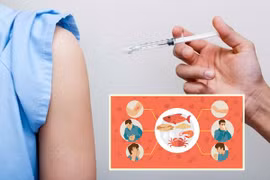 Người dị ứng thực phẩm lưu ý gì khi tiêm vắc xin COVID-19?