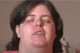 Mong muốn bị mù, cô gái làm điều ai cũng sợ 