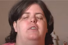 Mong muốn bị mù, cô gái làm điều ai cũng sợ 