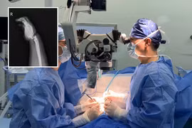 Chơi kéo co với con, mẹ suýt đứt lìa tay vì điều này