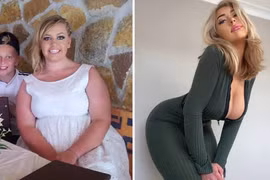 Thay đổi lối sống ở tuổi 16, cô gái giảm cân đáng kinh ngạc