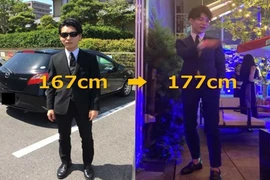 Muốn đẹp hơn, chàng trai chấp nhận đập gãy chân gây sốc