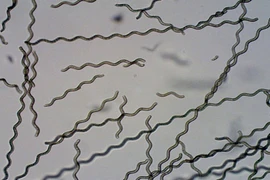 Đưa robot tảo siêu nhỏ vào cơ thể do thám và trị ung thư