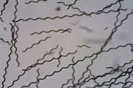 Đưa robot tảo siêu nhỏ vào cơ thể do thám và trị ung thư