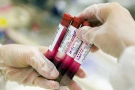 Xét nghiệm máu, biết được 8 loại ung thư 