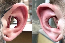 Rùng mình "dị nhân" khoét bỏ vành tai chỉ vì ham muốn...