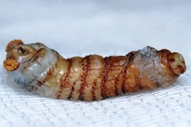 Kinh hoàng những động vật nhầy nhụa trong cơ thể người (1)