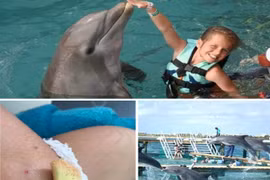 Cá heo nổi điên tấn công, quyết tâm dìm chết bé gái