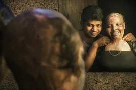 Cô gái bộ dạng “nửa người nửa quỷ” và giấc mơ tình yêu thành hiện thực